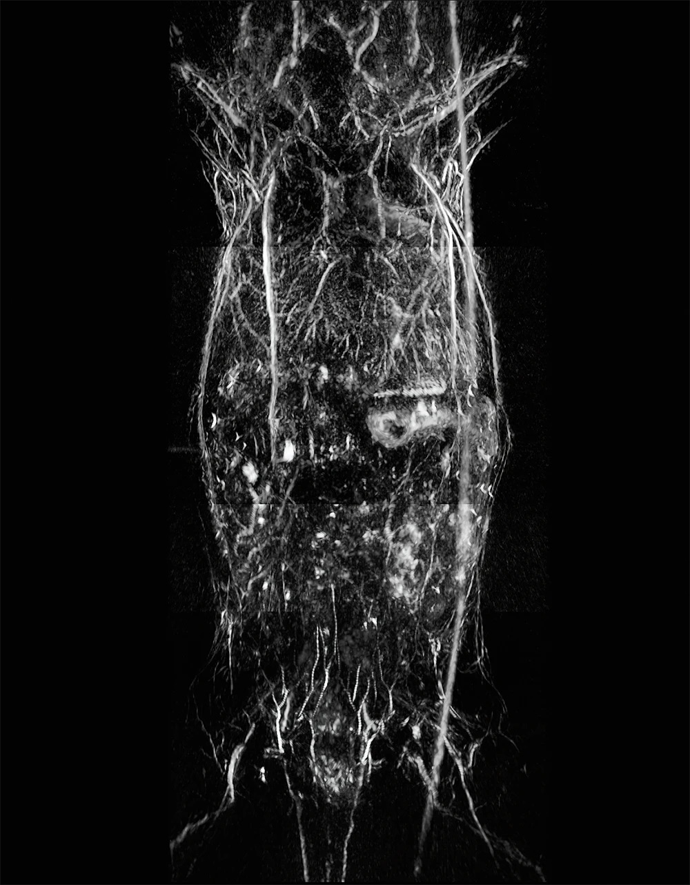 Photoacoustic image of a mouse.